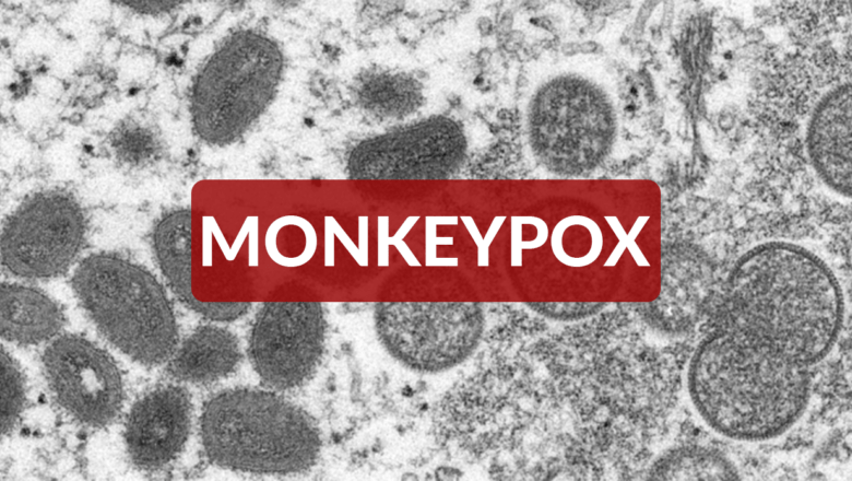 RCPH Confirms First Monkeypox Case in Randolph County